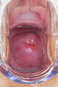 Vaginae of Sandra Sanchez